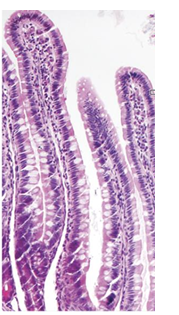 <p>simple columnar epithelium with goblet cells and microvilli, with lacteals</p>