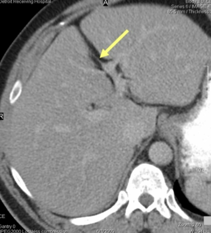 <p>what is the arrow pointing to?</p>