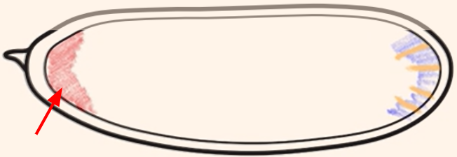 <p>Which cytoplasmic determinant is shown in the figure?</p>