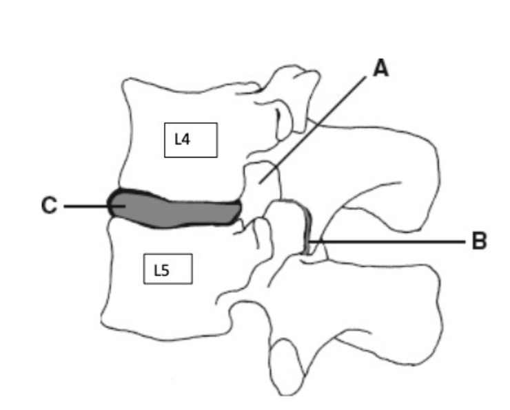 <p>B</p>