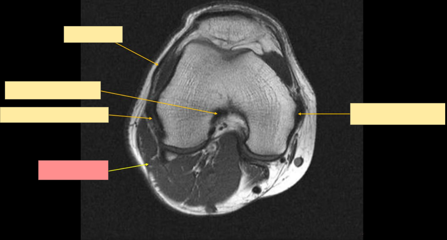 <p>Identify this structure</p>