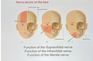 <p>what are these holes</p>