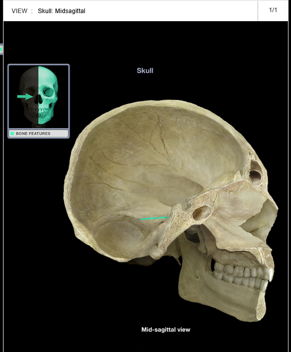 <p>Groove for superior petrosal sinus</p>