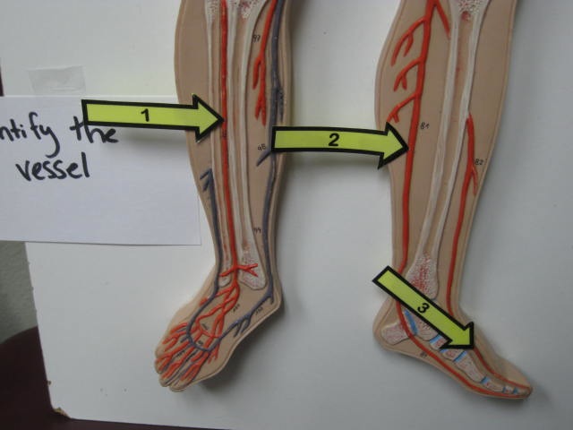 <p>Identify The Vessel 1, 2 and 3?</p><p>Lab Image 3-11</p>