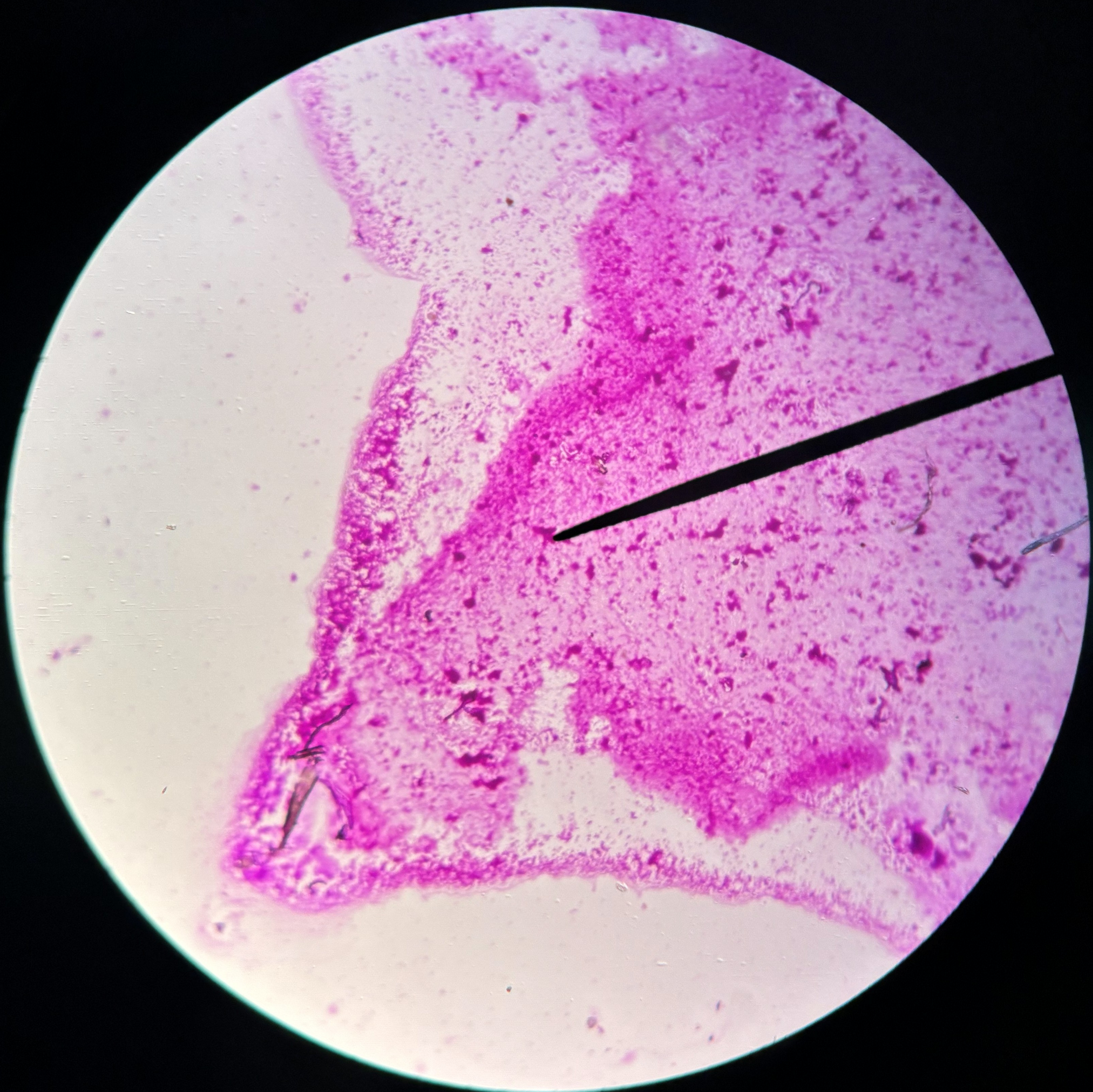<p>What gram stain is this?</p>