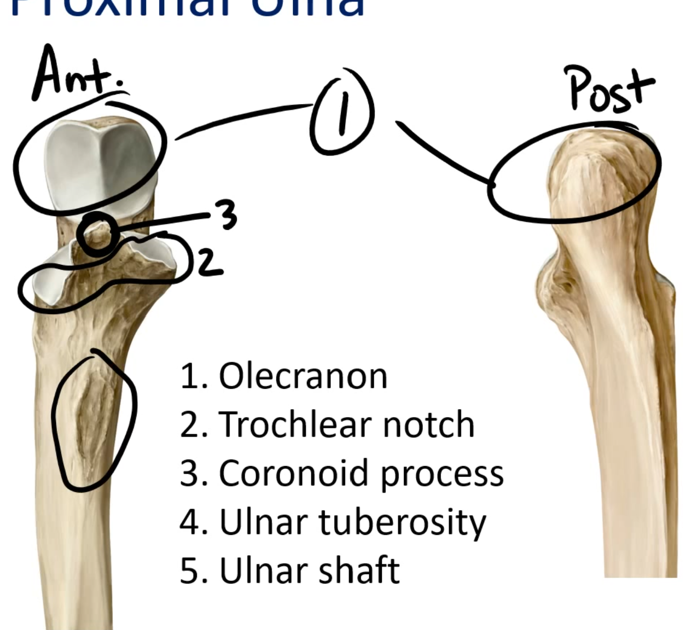 <p>1. Olecranon </p><p>2. Trochlear notch </p><p>3. Coronoid process '</p><p>4. Ulnar tuberosity </p><p>5. Ulnar shaft</p>