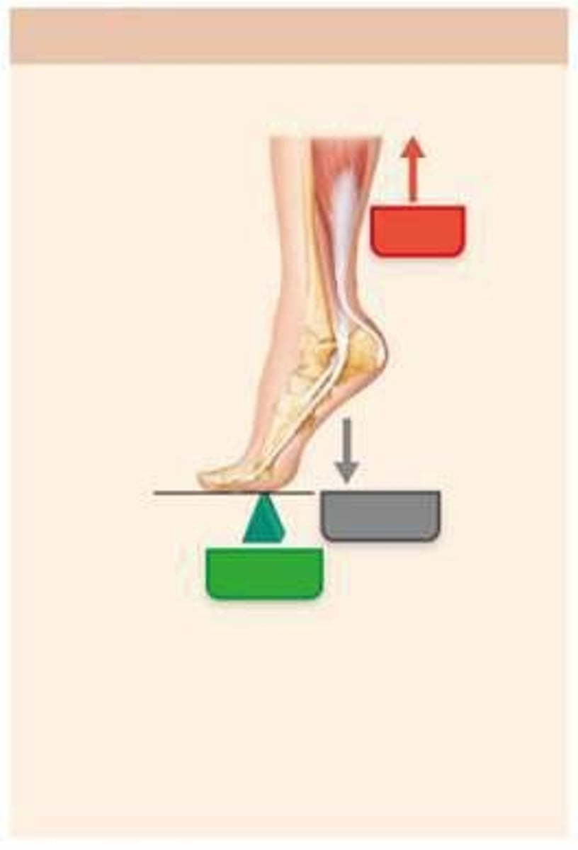 <p>It is involved in plantar flexion of the foot.</p>