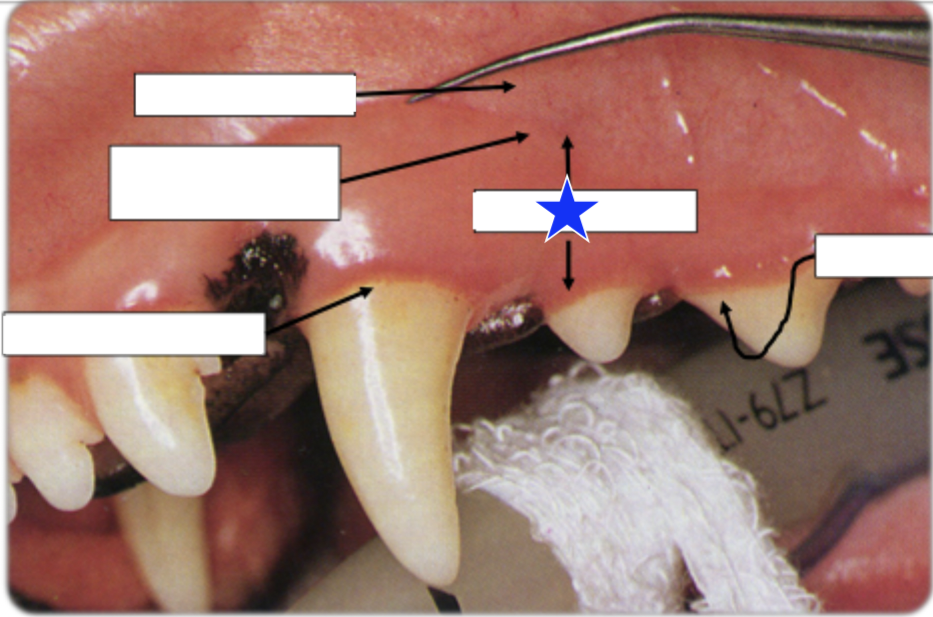 <p>What part of the gingiva is indicated by the star?</p>