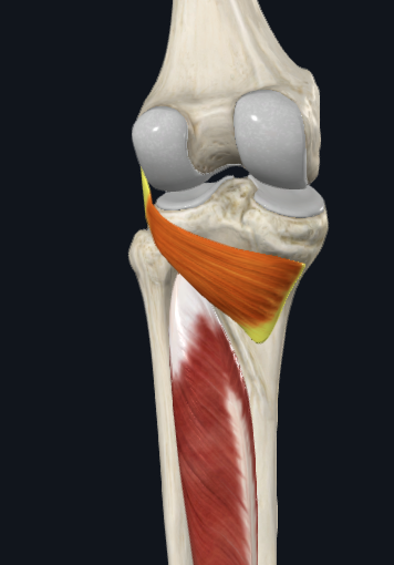 term image
