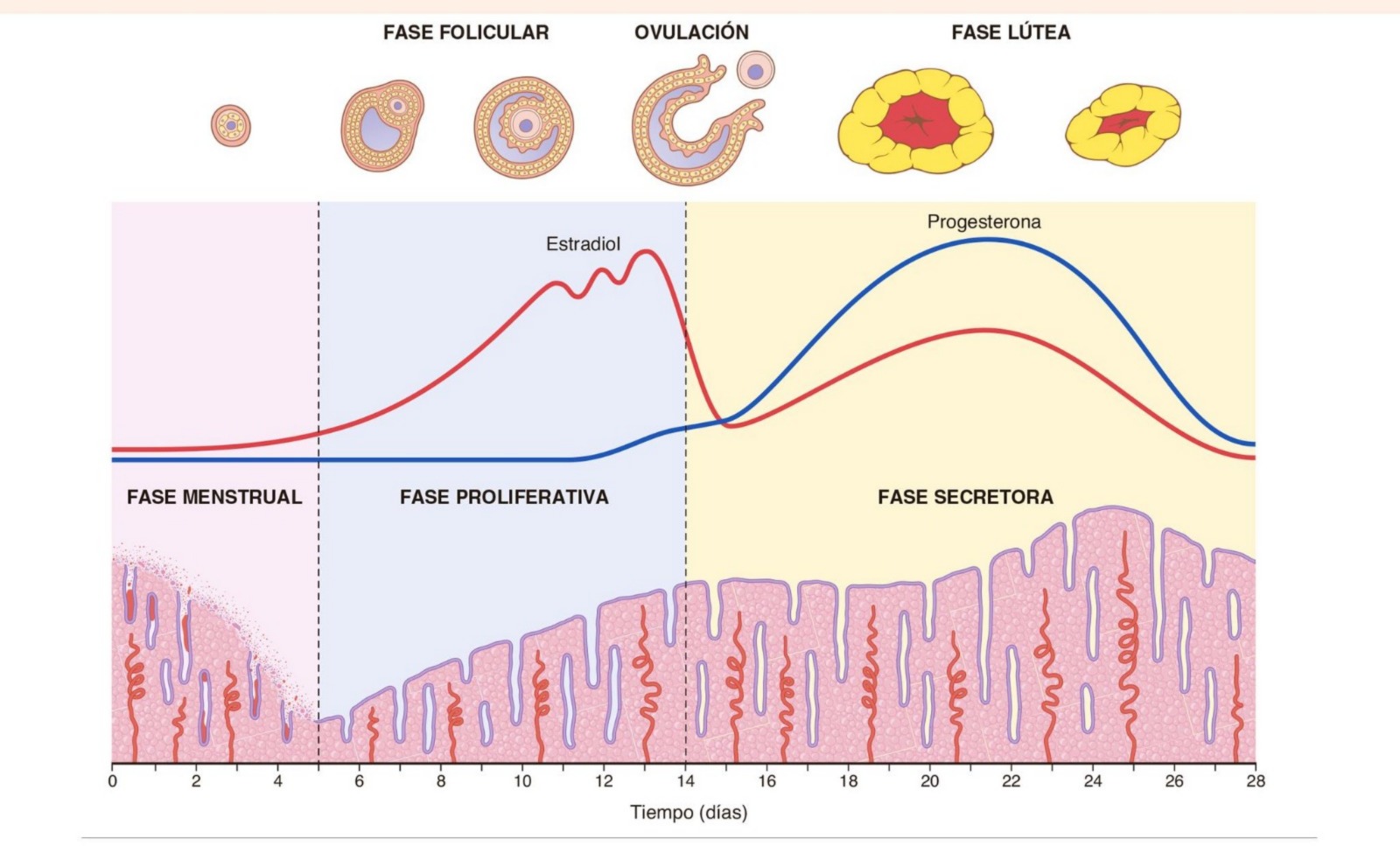 <p><strong>Proliferativa y </strong><span style="color: rgb(238, 93, 160);"><strong>estrógeno</strong></span><strong> (</strong>glándulas compactas, pequeñas y sin inflamación; reconstrucción del endometrio<strong>)</strong></p>