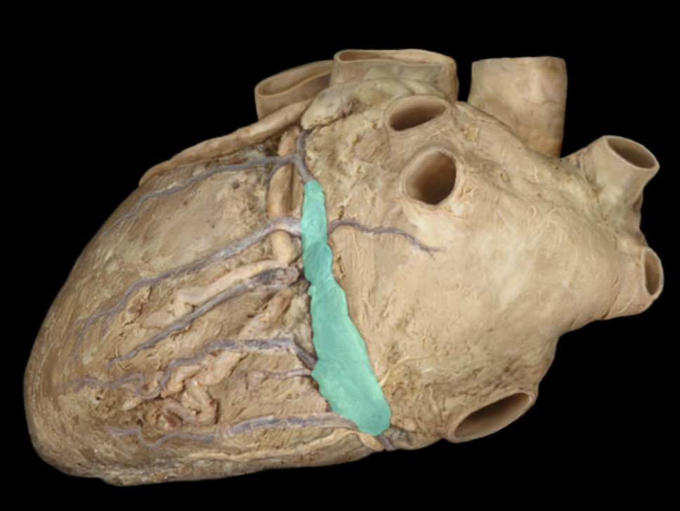 <p>Identify the coronary vein</p>