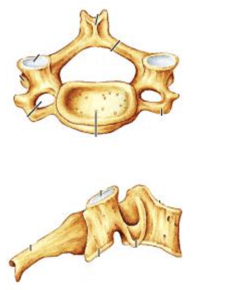 <p><span>Identify the indicated type of vertebra.</span></p>