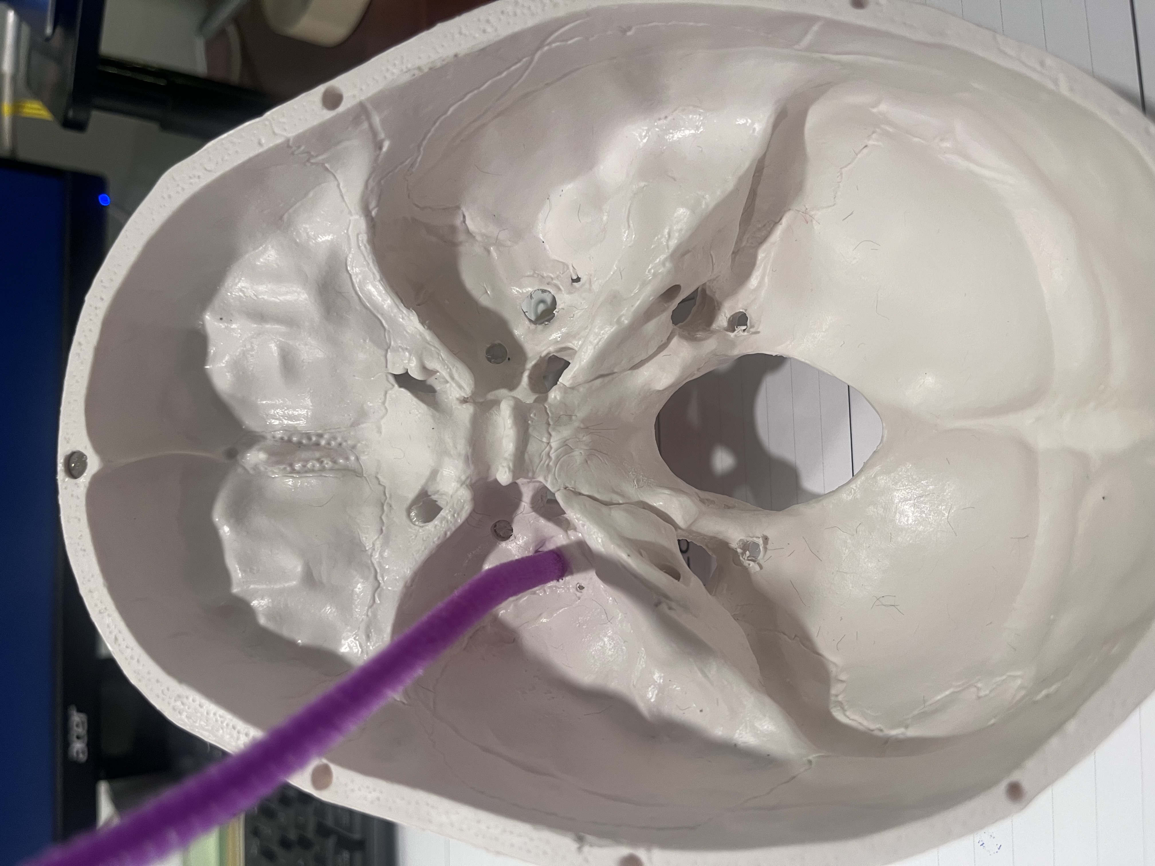 <p>What cranial nerve(s) are represented by the purple pipe cleaner?</p>
