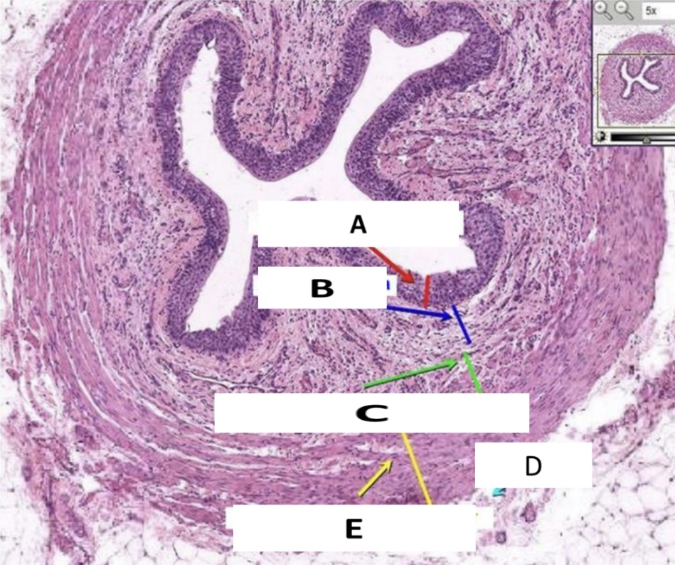 <p>Name the structure indicated by D.</p>