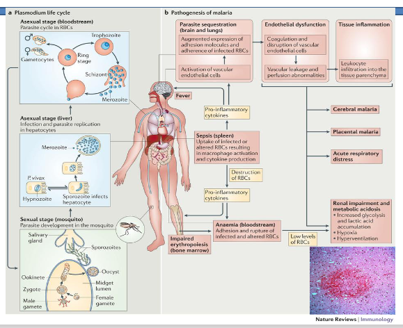 <p>Pathology - Why do kids die of malaria</p>