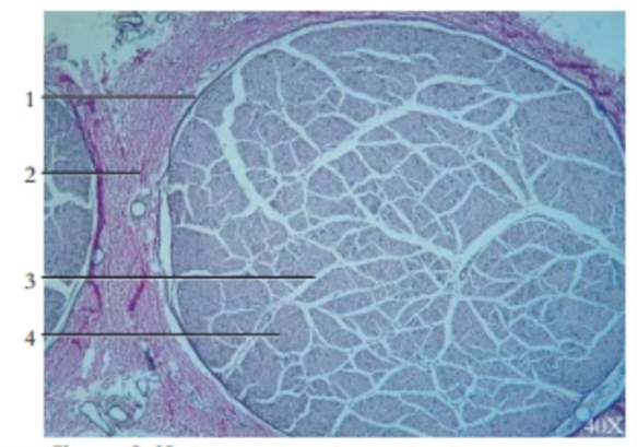 <p><span style="background-color: transparent;">Cross-section of a peripheral nerve</span></p>