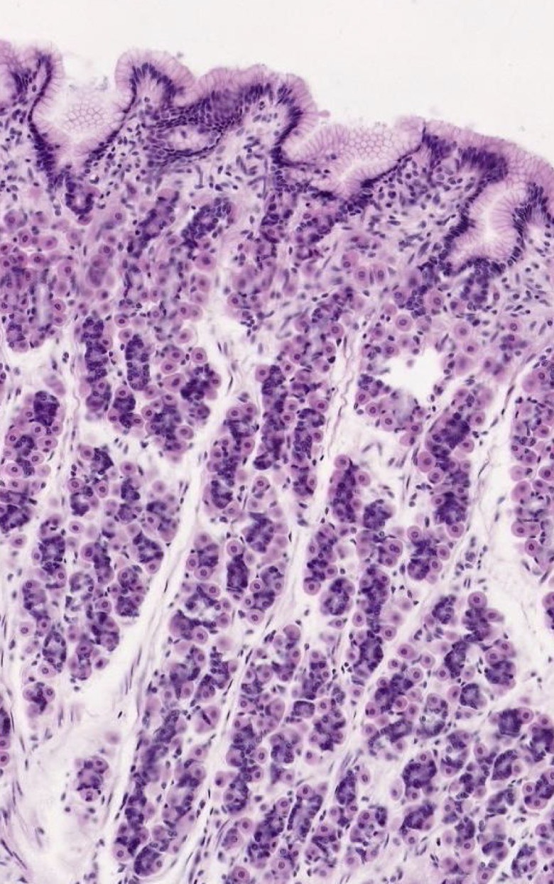 <p>What area of the stomach is this?</p>