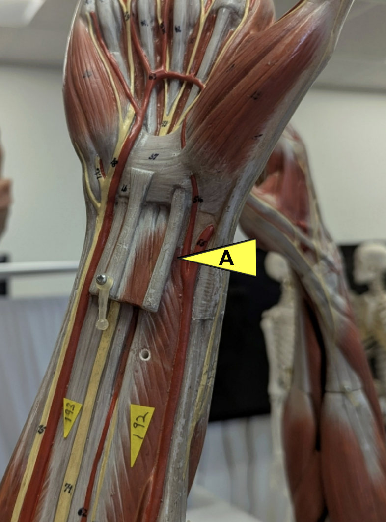 <p>ID all muscles shown</p>