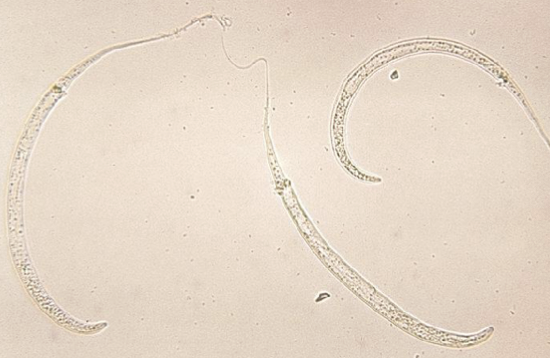 <ul><li><p>adult form, egg and larva form </p></li><li><p>guinea worm </p></li><li><p>dracunculiasis</p></li></ul><p></p>