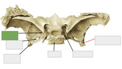 <p>This is the</p>