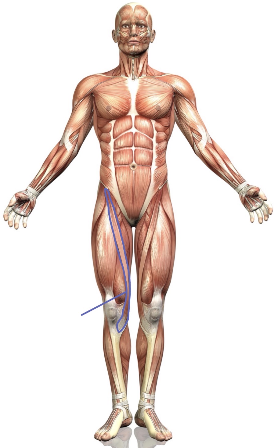 <p><strong>Name the following muscle</strong></p>