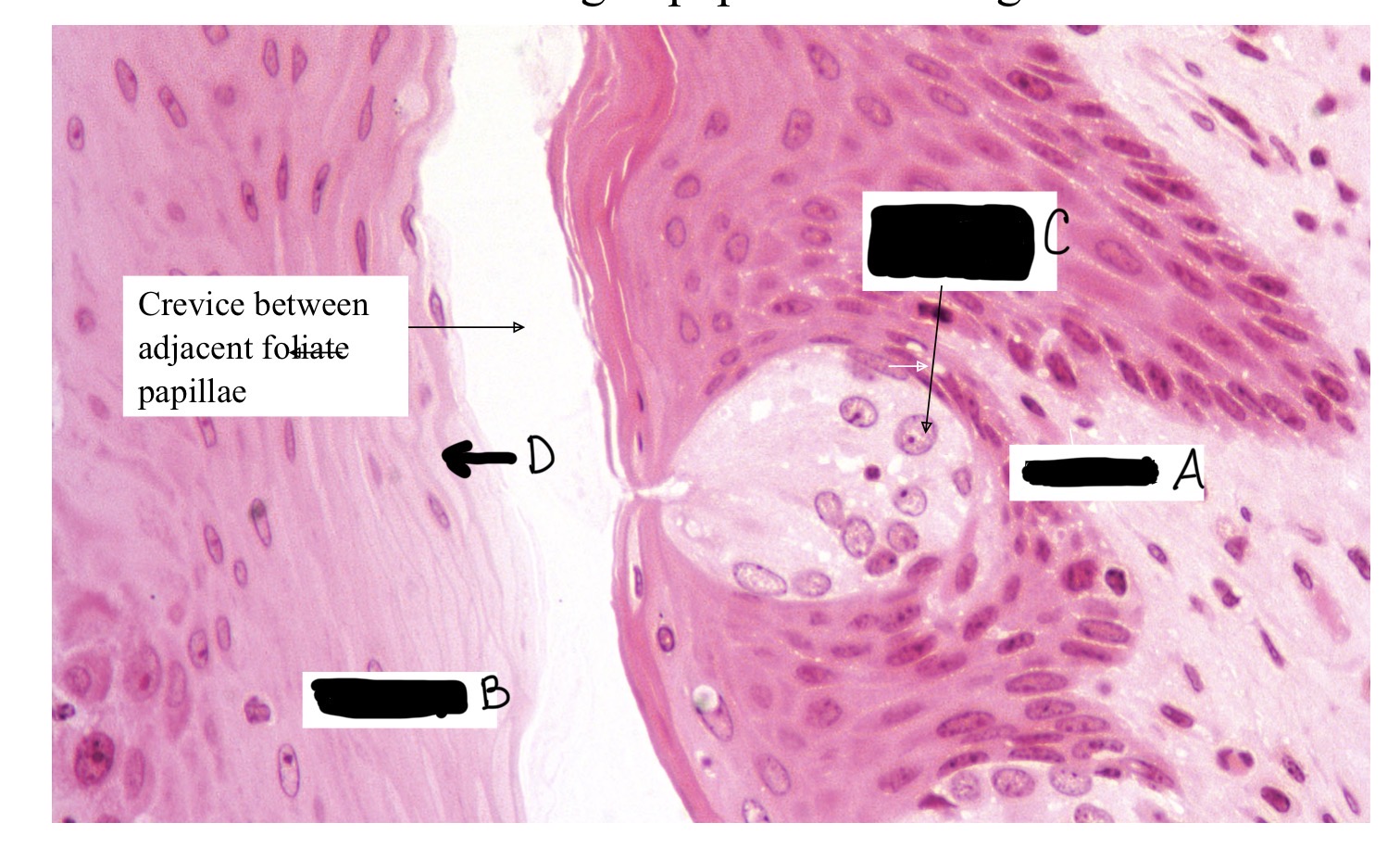 <p>Label: stratified squamous epithelium, taste pore, taste bud, + taste cell nuclei</p>