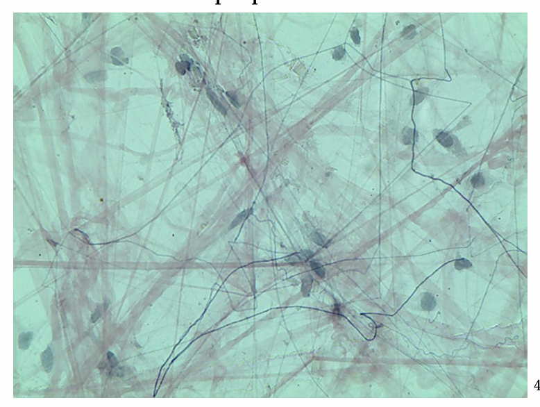 <p>what is this tissue</p>