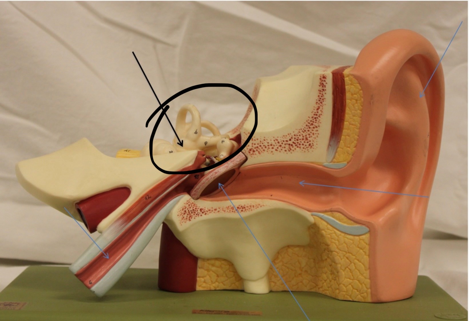 <p>Identify the circled area?</p>