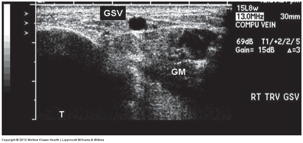 <p class="s31">&nbsp;</p>