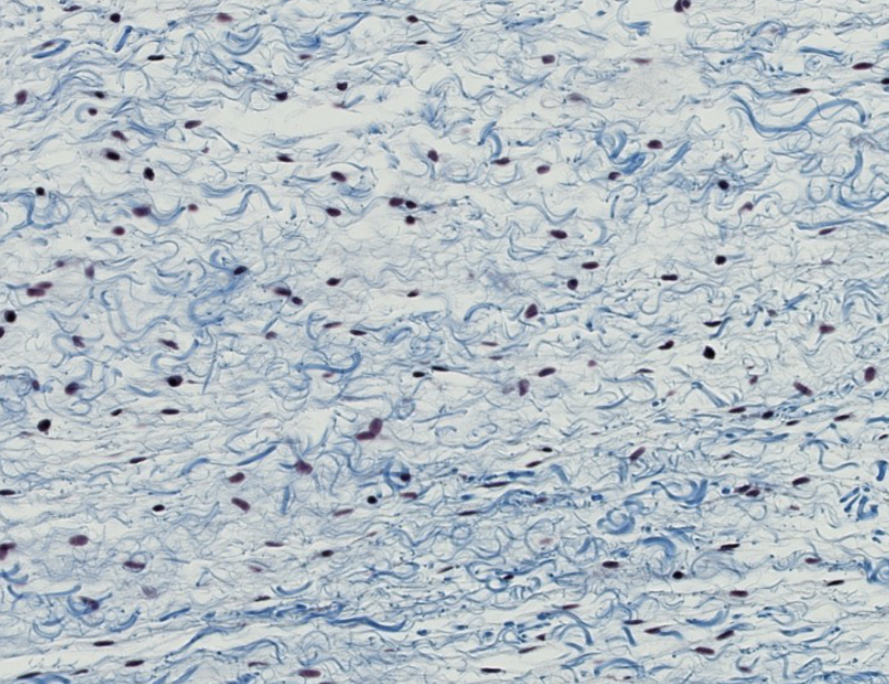 <ol><li><p>what type of basic CT is this? be specific.</p></li><li><p>what is another name for this CT?</p></li></ol><p></p>