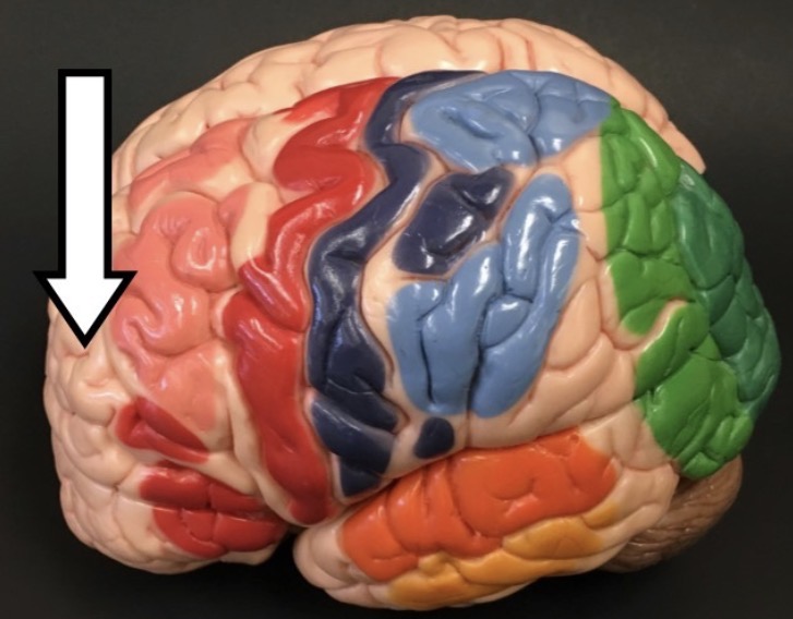 <p>What lobe is the arrow pointing to?</p>