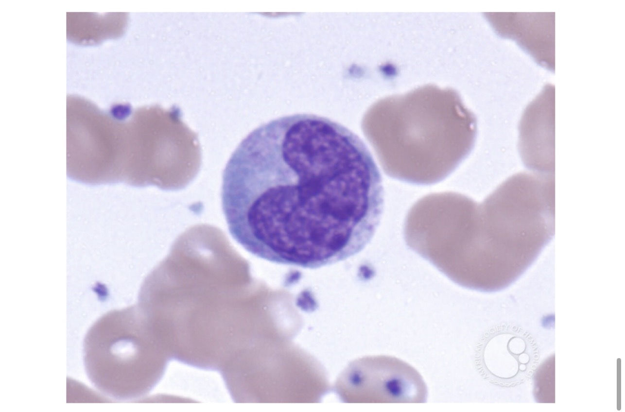 <p>A. What White blood cell is this? </p><p>B. What does it target? </p><p>C. What is the Mature form called? </p>