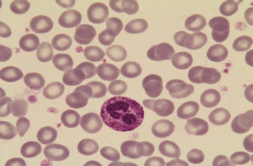 <p>what is toxic granulation?</p>