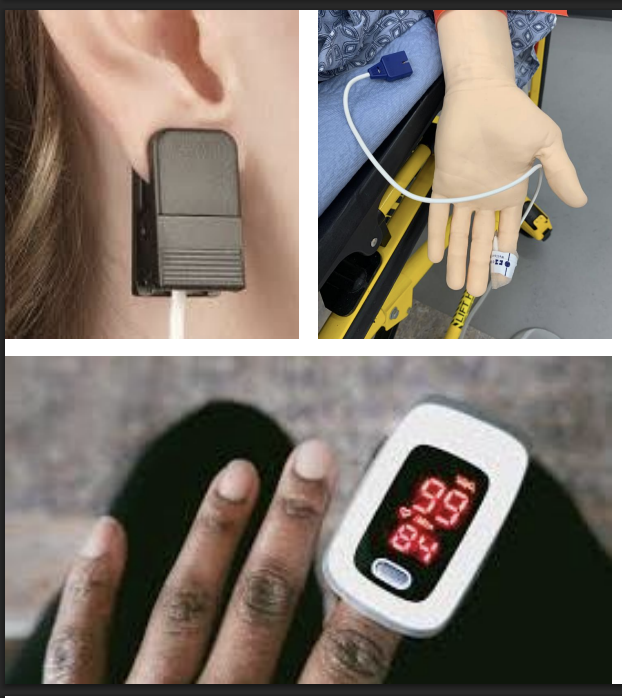 <p>Lead </p><p>Purpose: monitors oxygen saturation, also monitors heart rate</p>