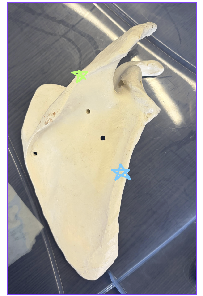 <p>Green star: Name this structure </p><p>Blue star: Name this structure</p><p>Name one muscle that originates along the blue star structure </p>