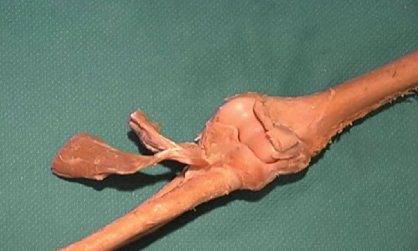<p>What type of joint is this?</p>