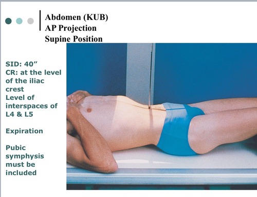 <p>position: supine, legs extended and arms to the side, MSP should be centered to midline of IR</p><p></p><p>IR: portrait 14 × 17</p><p></p><p>breathing instructions: exposure at end of expiration</p><p></p><p>technique: 70-85, 22-25</p><p></p><p>SID: 40</p><p></p><p>CR: level of iliac crests</p><p></p><p>marker: right marker on bottom ride side</p>
