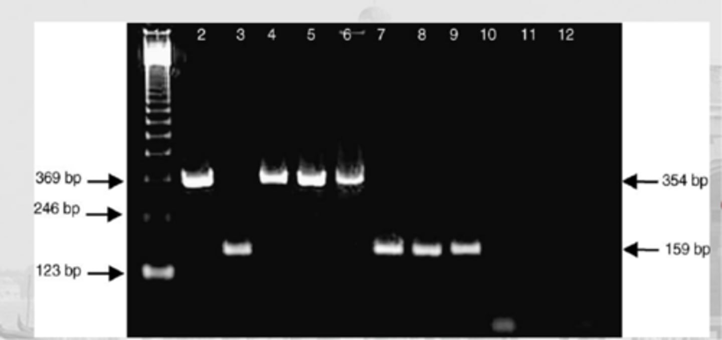 <p>ethidium bromide</p>