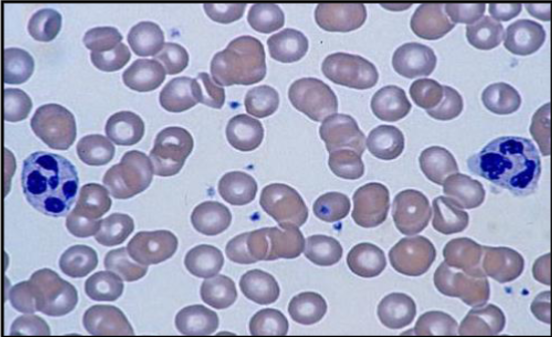 <p>This smear is considered?</p>
