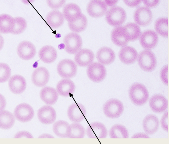 <p>What is the arrow at the top pointing to?</p>