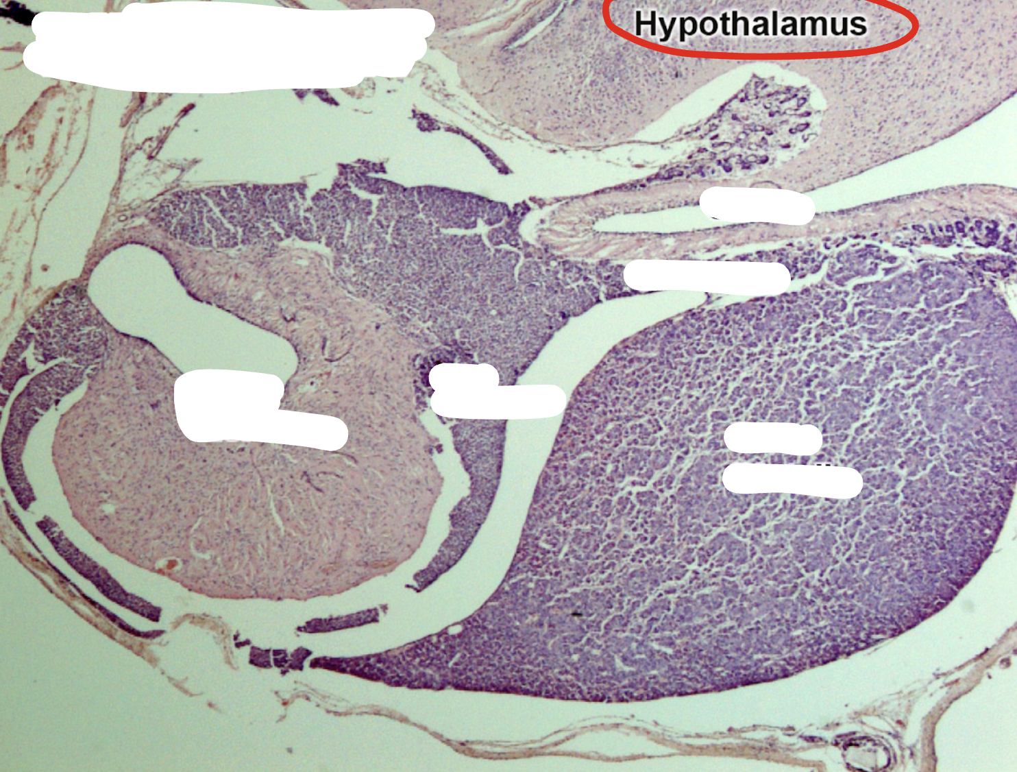 <p>Hypothalamus </p>