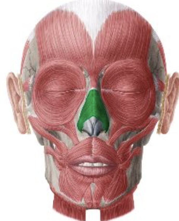 <p>Which muscle is this?</p>