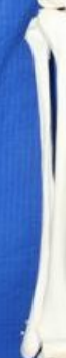 <p>What bone is this? What view of the bone is this?</p>
