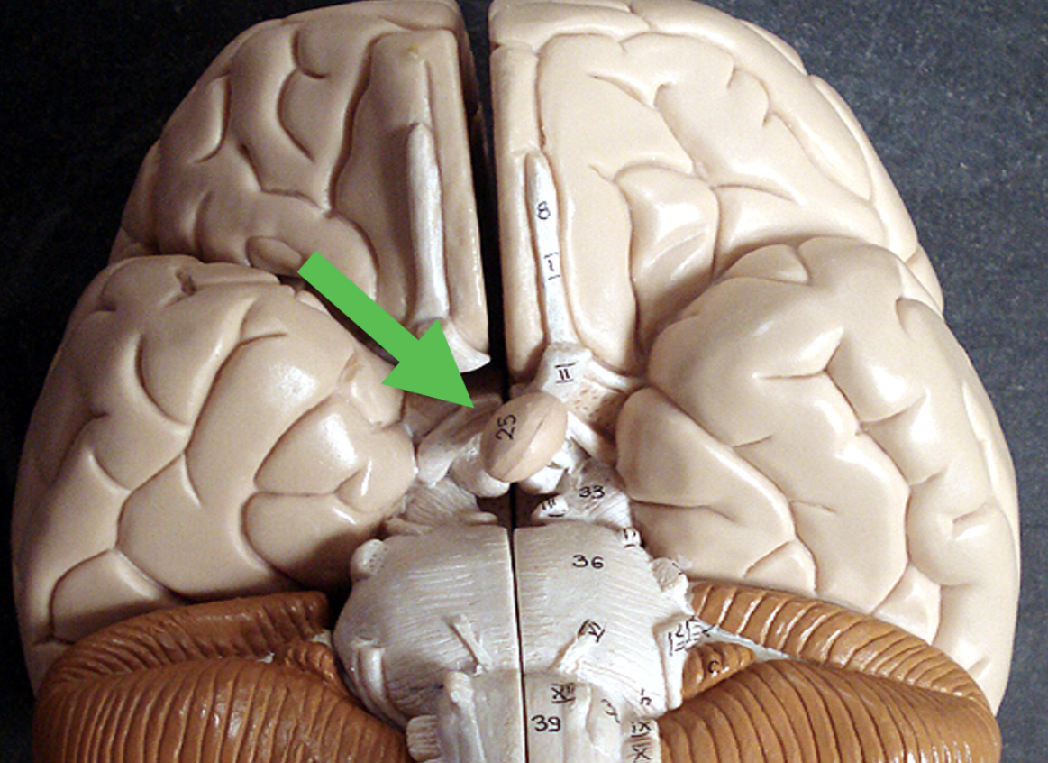 <p>Identify the area of the brain at the tip of the pointer.</p>