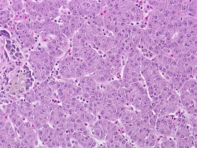 <p>a.) What is this organ?</p><p>b.) What are the pointed structures?</p>