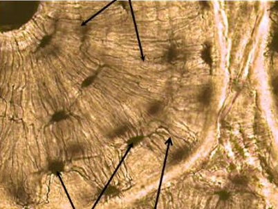 <p>bone/osseous connective tissue</p>