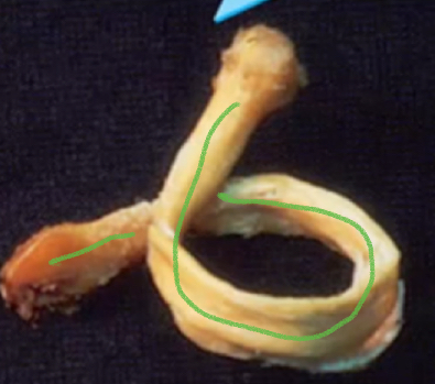 <p>If you soak a bone in acid, why is it bendy?</p>