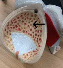 <p>Identify these folds.</p>