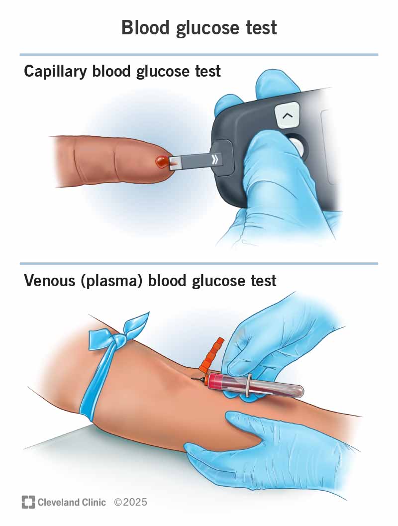 <p>blood sugar / blood glucose</p>