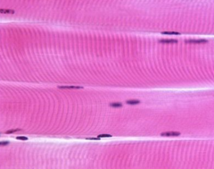 <p>What muscle type is this?</p>